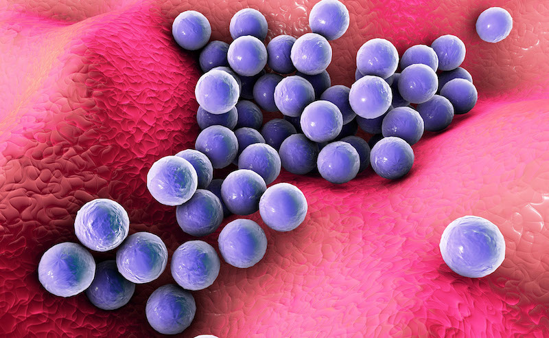SUSCEPTIBILIDAD A NETILMICINA Y OTROS ANTIBIÓTICOS DE ESTAFILOCOCOS RESISTENTES A LA METICILINA EN TERAPIA OFTÁLMICA